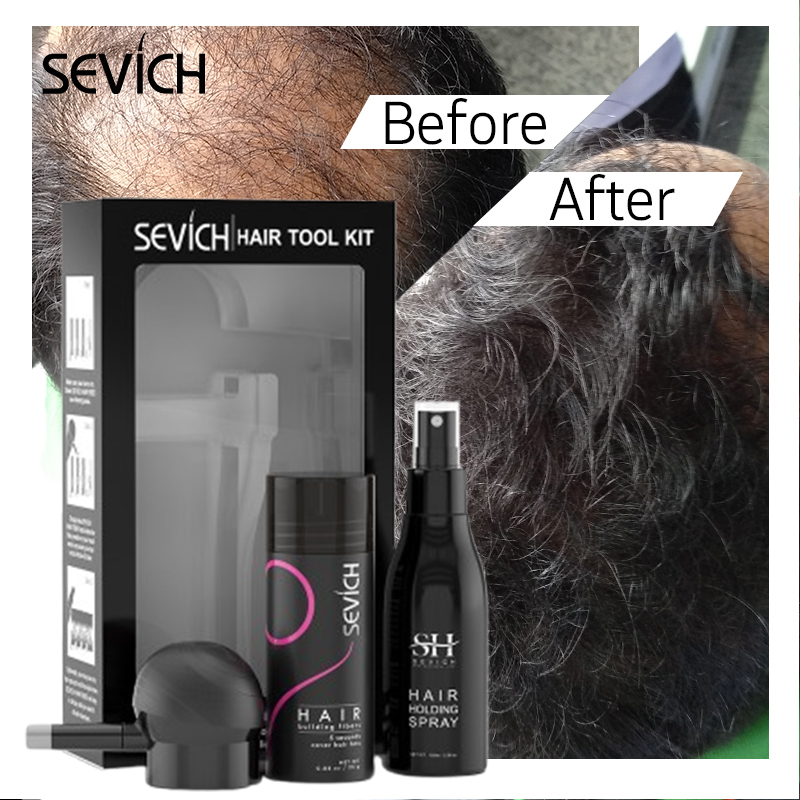 Keratin Treatment Set - 黒髪繊維セット 育毛繊維 ケラチン増毛スプレー 育毛繊維 脱毛症対策製品 パウダー