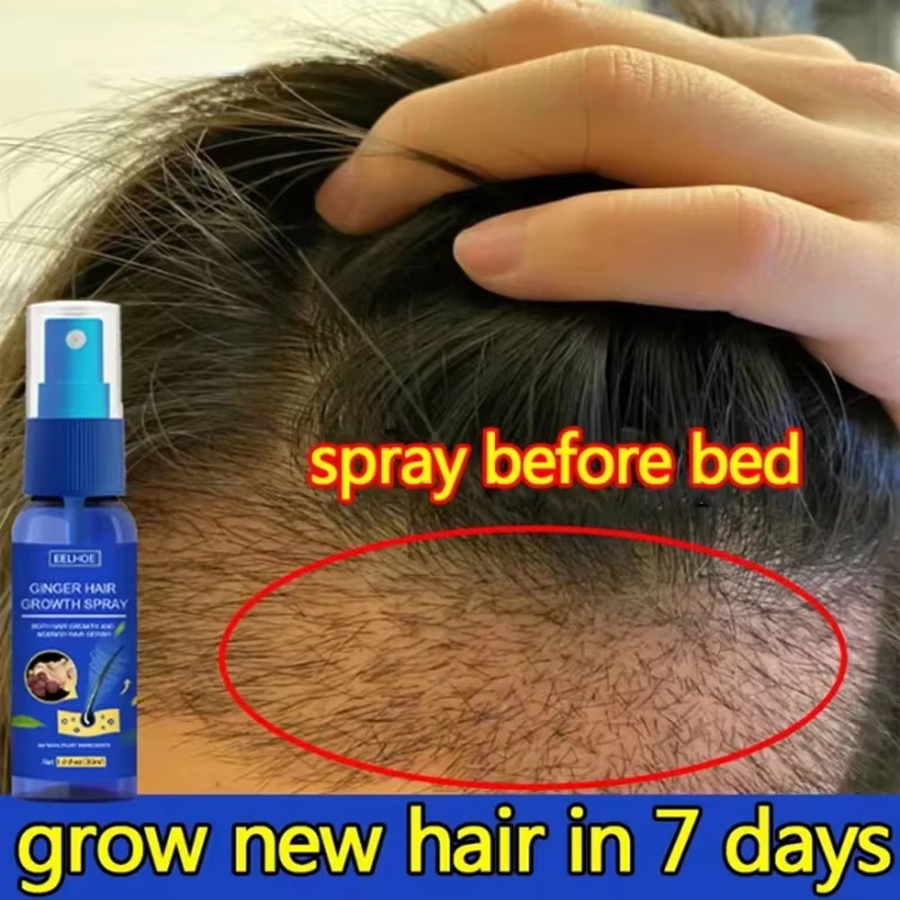Hair Care Oil Serum - 速効性ジンジャーヘアグローススプレー、毛根育成、脱毛防止、育毛セラム、頭皮ダメージ修復、栄養ケア製品、女性男性用