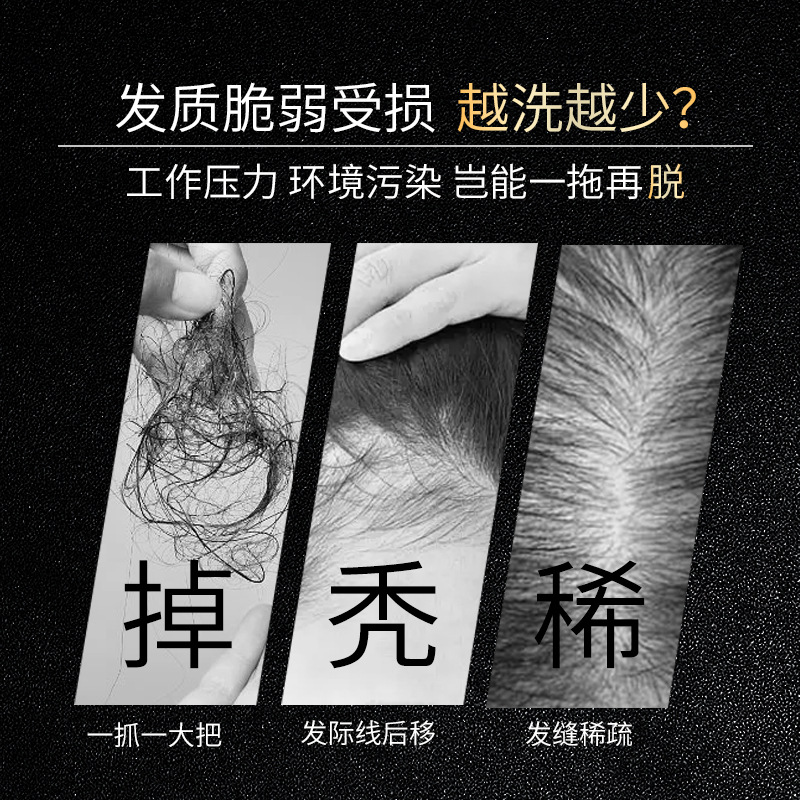 ファムラン　抗脱毛シャンプー　何首烏配合　育毛・頭皮ケア用 - Hair Care Normal のレビューと価格