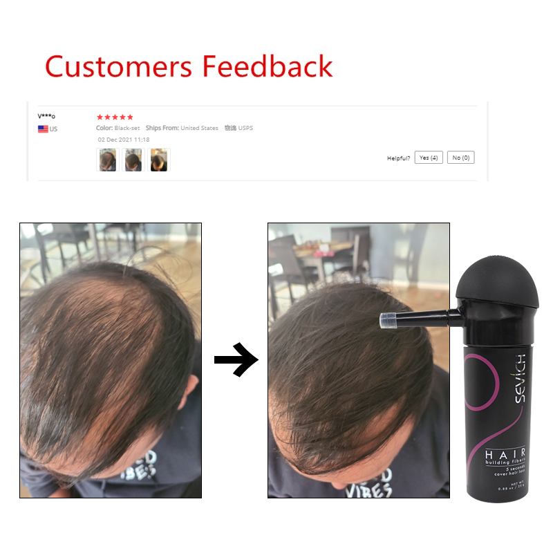 Sevich 2 ピース/ロット 10 色ヘアビルディングフ - Keratin Treatment Set のレビューと価格