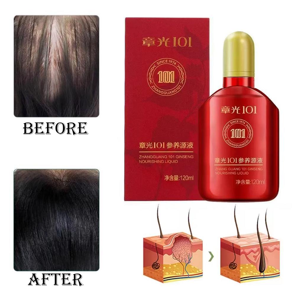 張光 101 フォーミュラ (101P) 120ml 漢方薬 - Hair Care Normal のレビューと価格